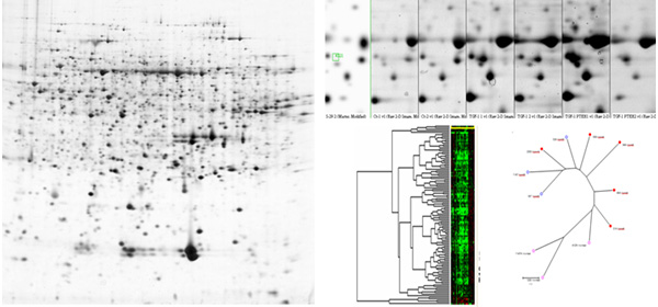 2-DE gel image analysis